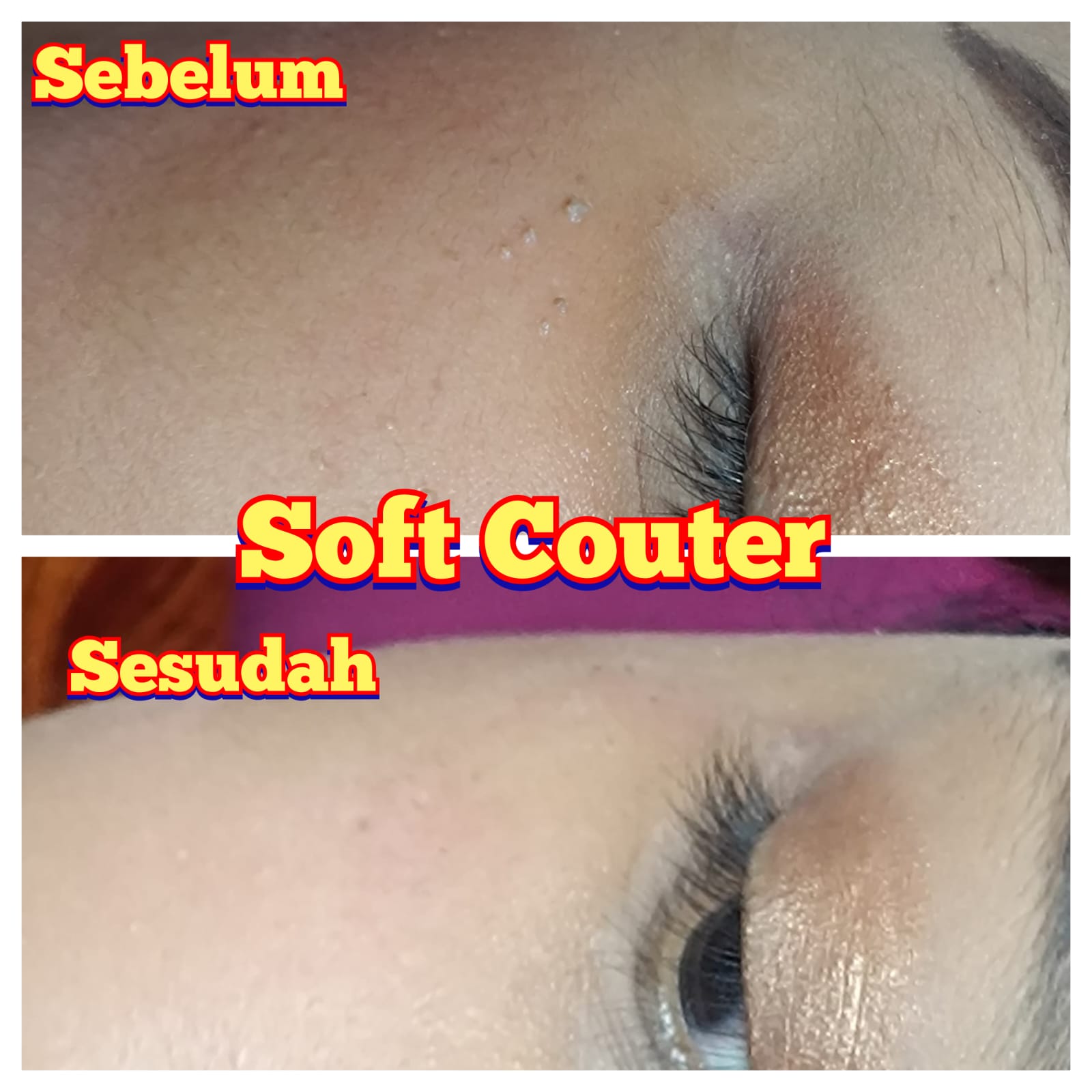 Testimoni Treatment 4 - DRW Skincare