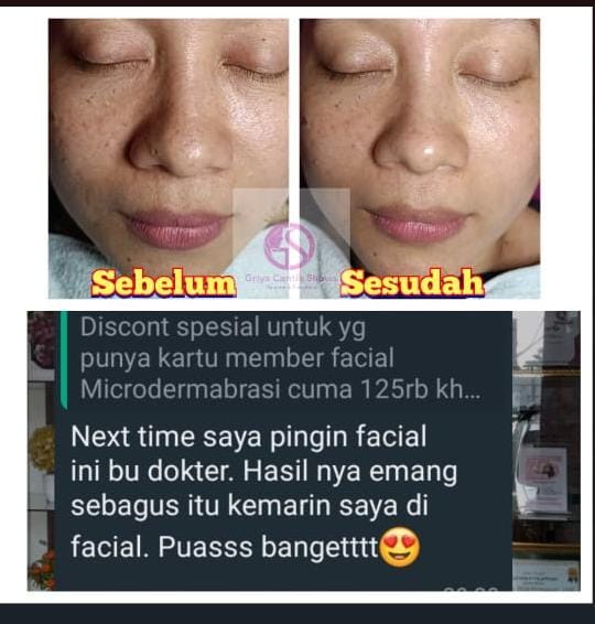 Testimoni Treatment 5 - DRW Skincare